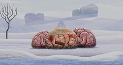 Brain 492